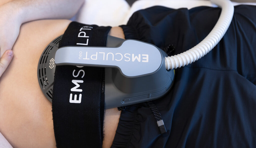 Close-up of a patient receiving treatment on their abdomen with Emsculpt NEO in Fargo and Fergus Falls